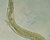 how do anthelmintics work