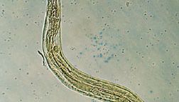 how do anthelmintics work